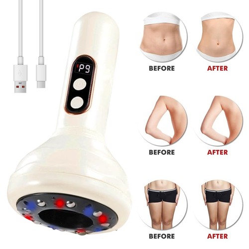 Electric cupping massager - electric,