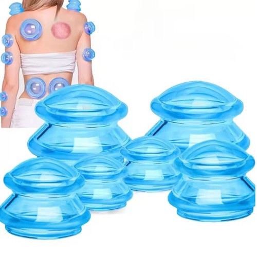 Cupping therapy set - set,, 3